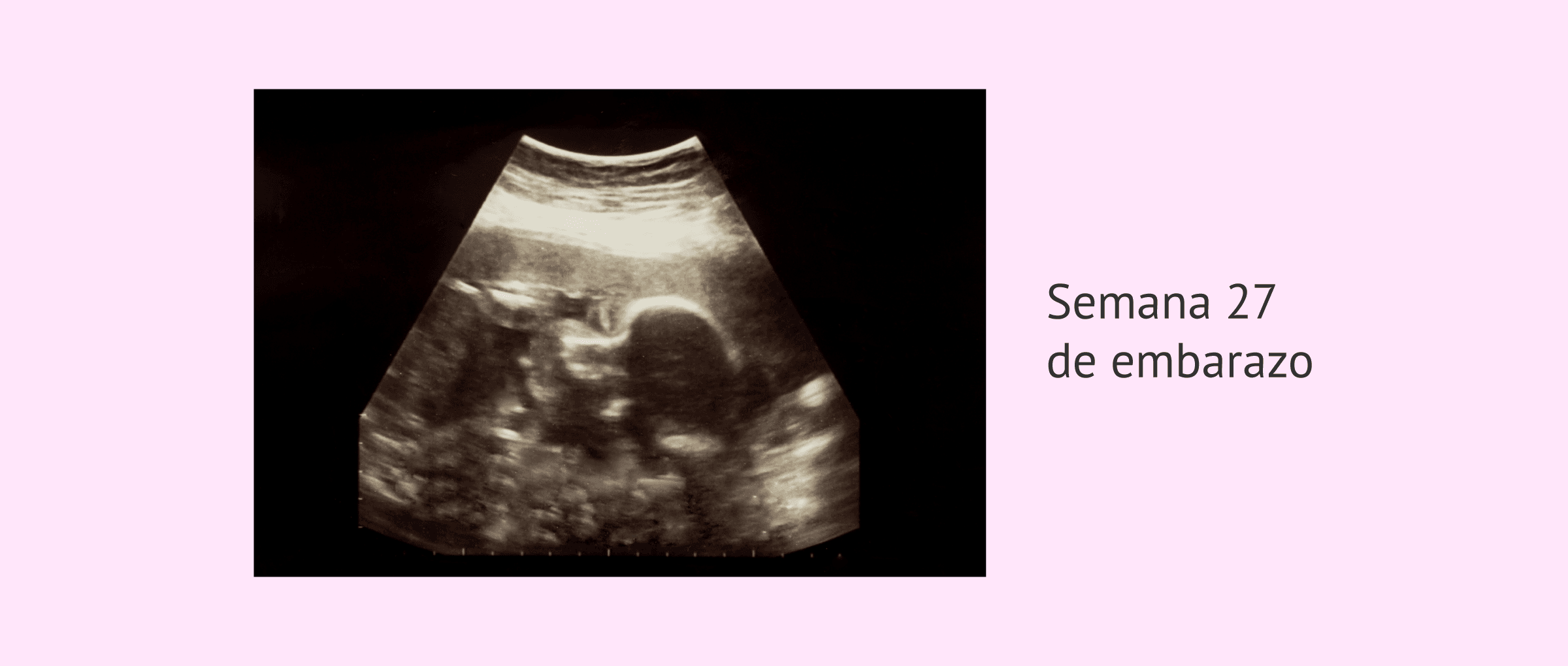 Imagen: Ecografía fetal a las 7 semanas