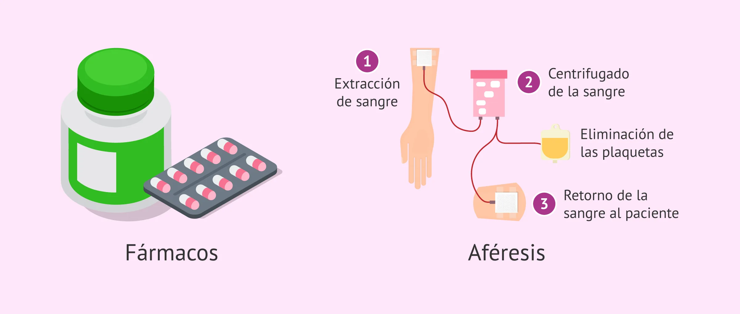 Opciones terapéuticas para el exceso de plaquetas