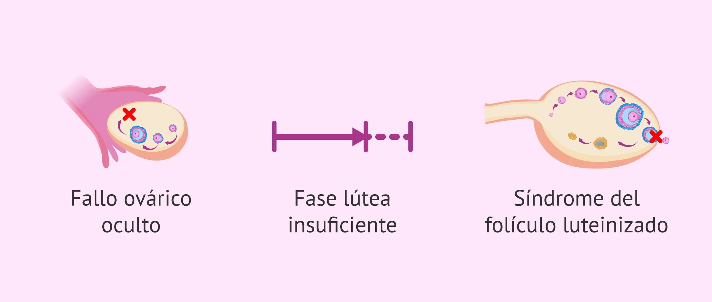 Imagen: ¿Por qué puede haber alteraciones de la ovulación?
