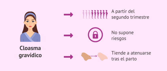 Imagen: Manchas en la cara de la embarazada