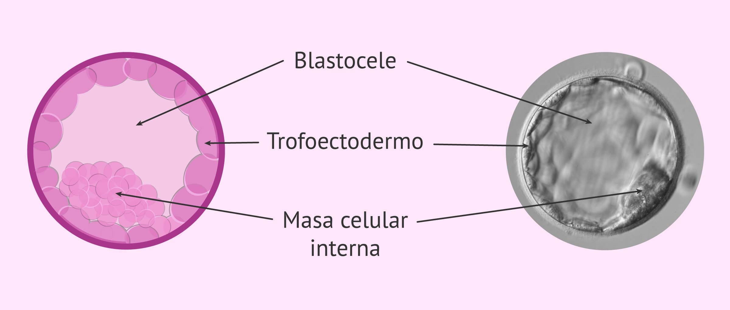 Imagen: Estructura de un blastocisto