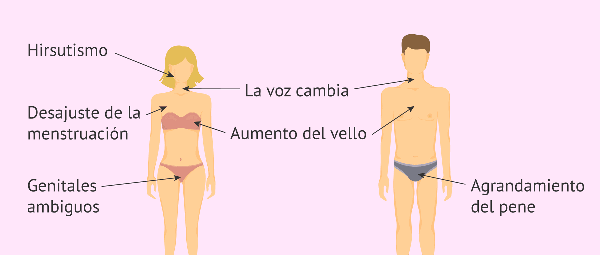 Imagen: Manifestaciones clínicas de la hiperplasia suprarrenal