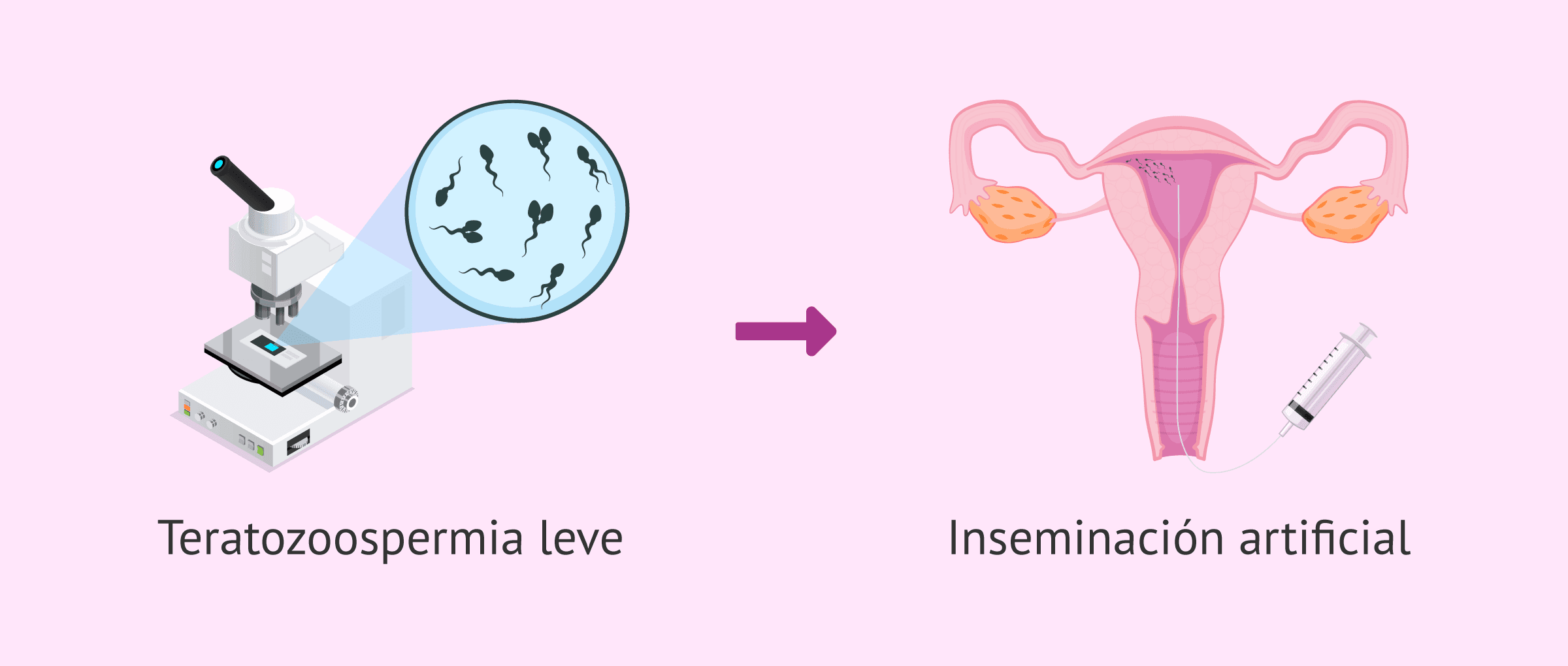 Imagen: IA para pacientes con teratozoospermia