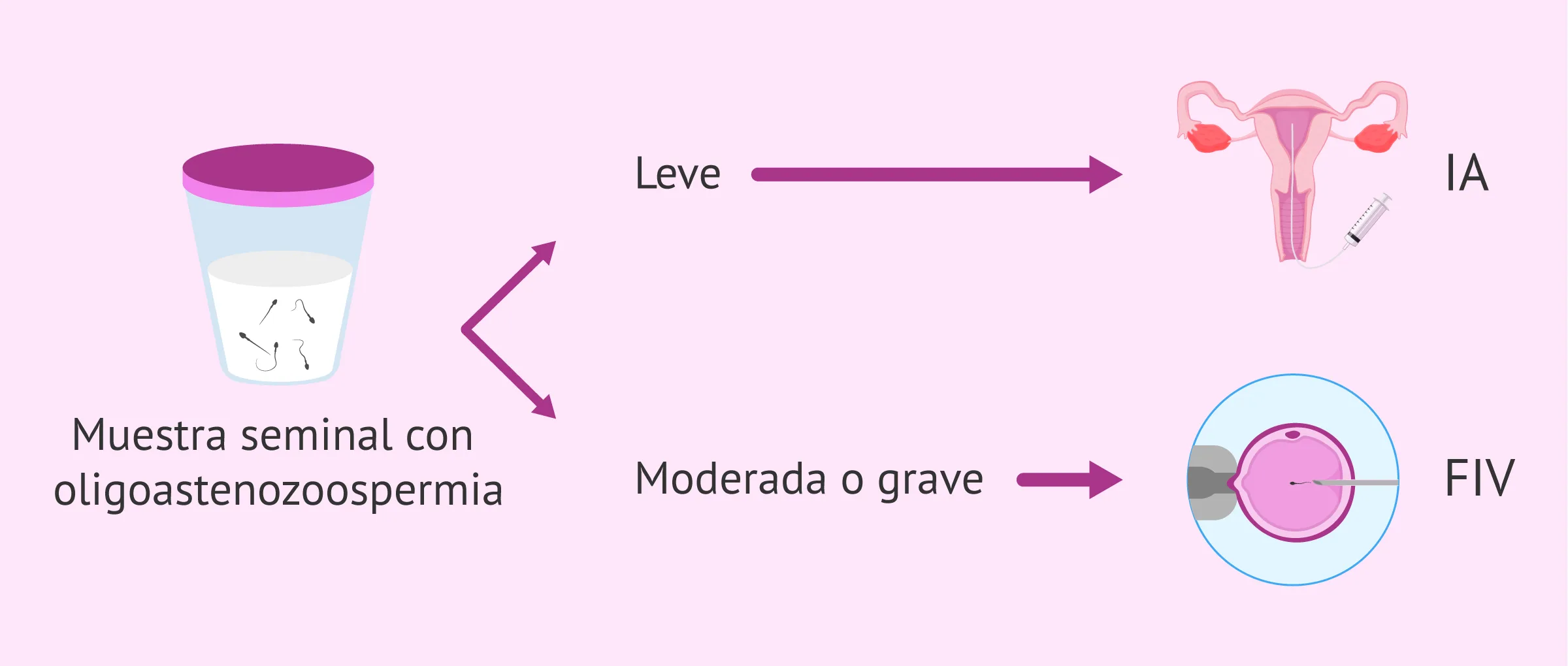 Tratamientos reproductivos para lograr el embarazo con oligoastenozoospermia