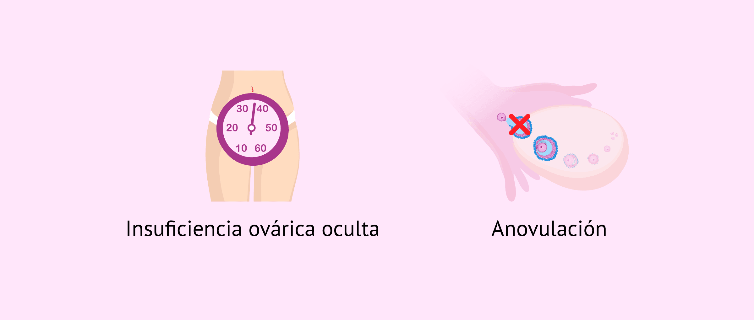 Imagen: Insuficiencia ovárica y anovulación