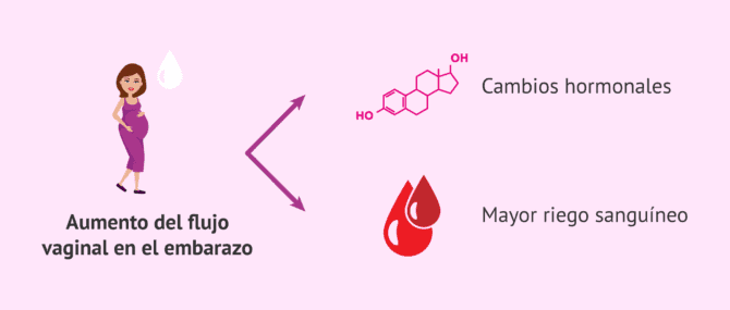 Imagen: Causas del aumento del flujo vaginal en el embarazo