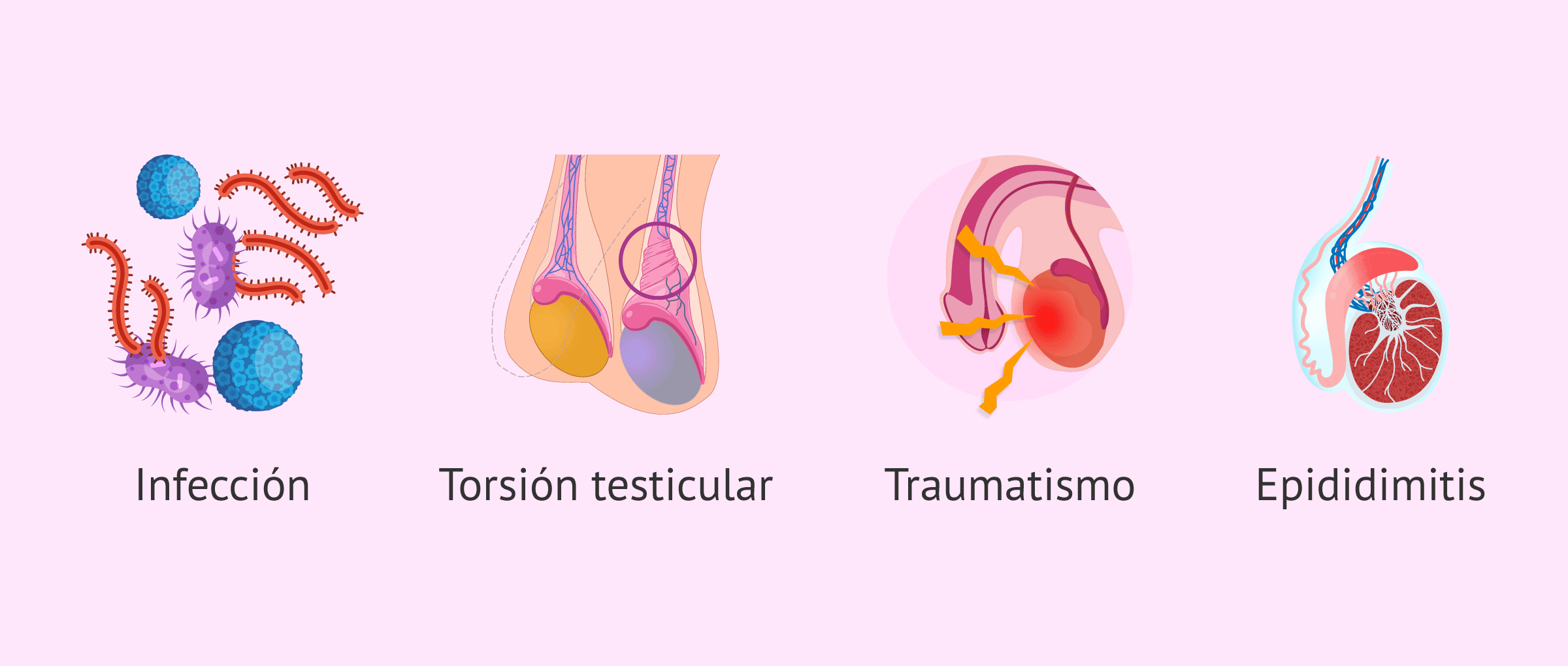 Imagen: Causas del hidrocele no comunicante