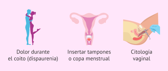 Imagen: Dolor como consecuencia del vaginismo