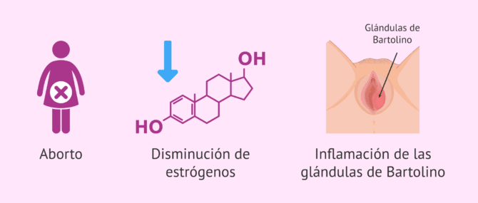 Imagen: ¿Cuáles son las causas fisiológicas del vaginismo?
