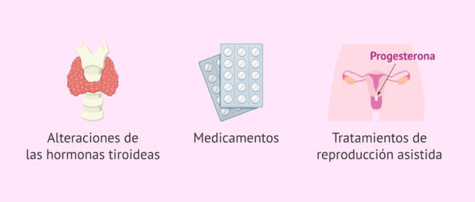 Imagen: Otras posibles causas de un retraso en la regla