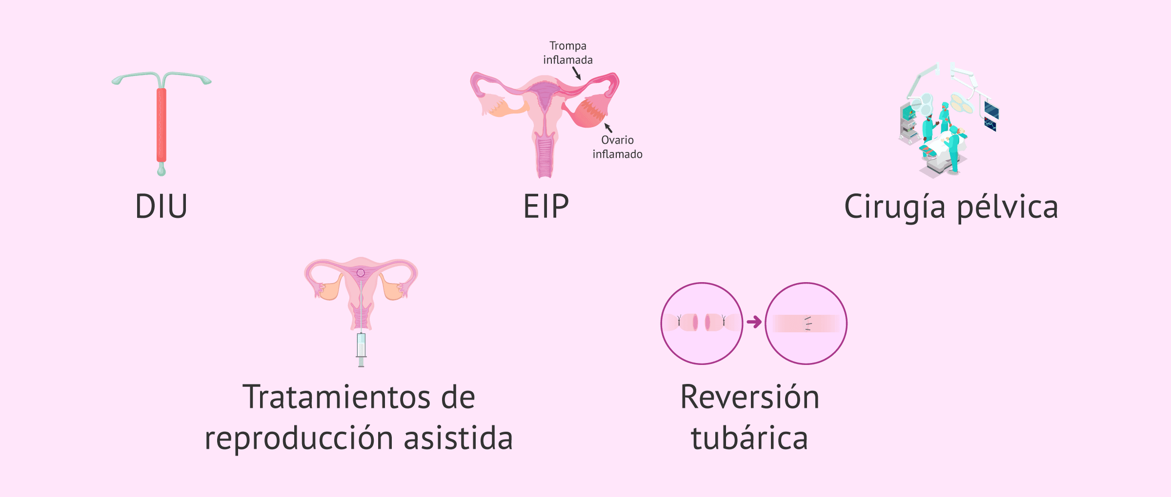 Imagen: Otros factores de riesgo del embarazo extrauterino