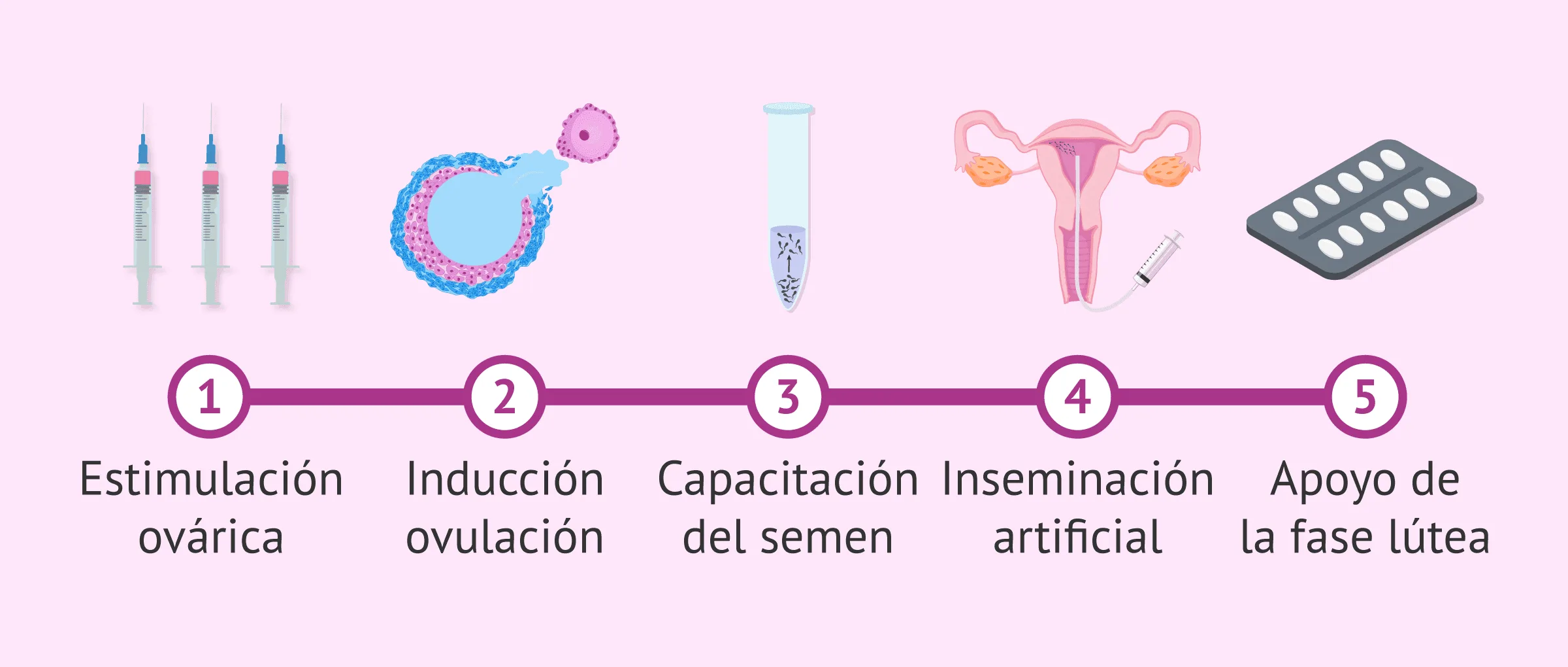 La inseminación artificial