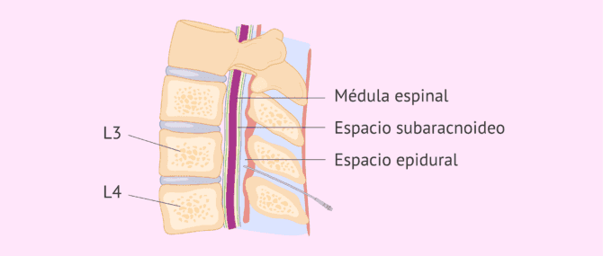 Imagen: Bebé recién nacido
