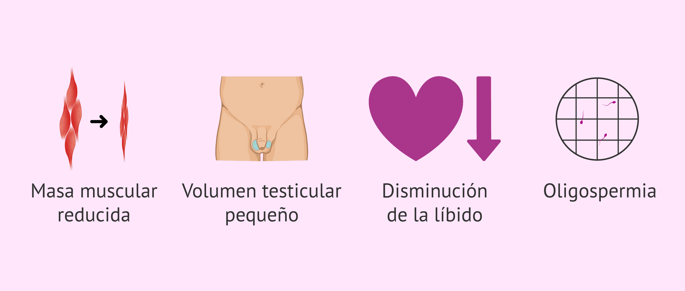 Imagen: Manifestaciones clínicas del síndrome de Kallmann en el hombre