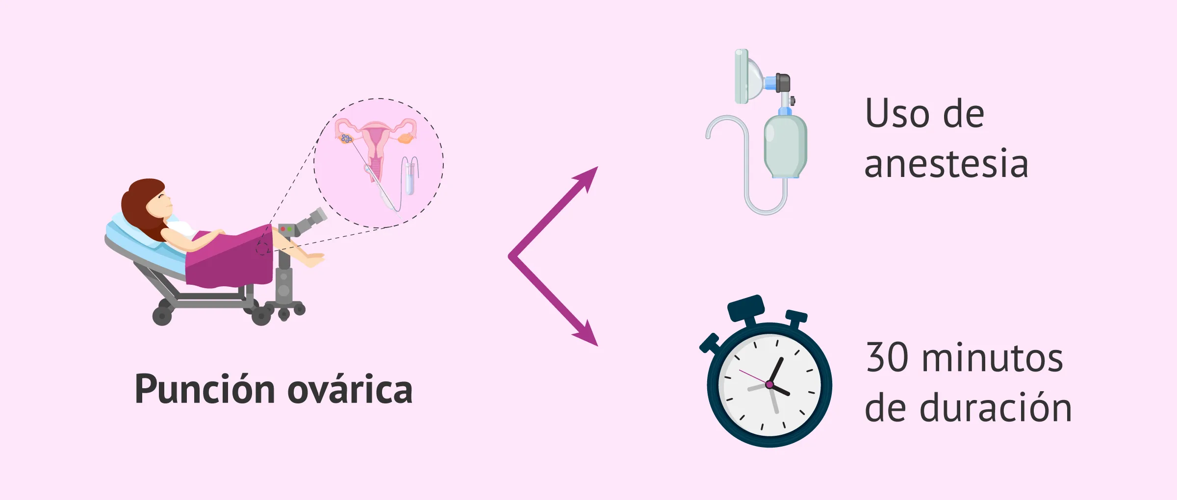 Imagen: Características de la punción ovárica