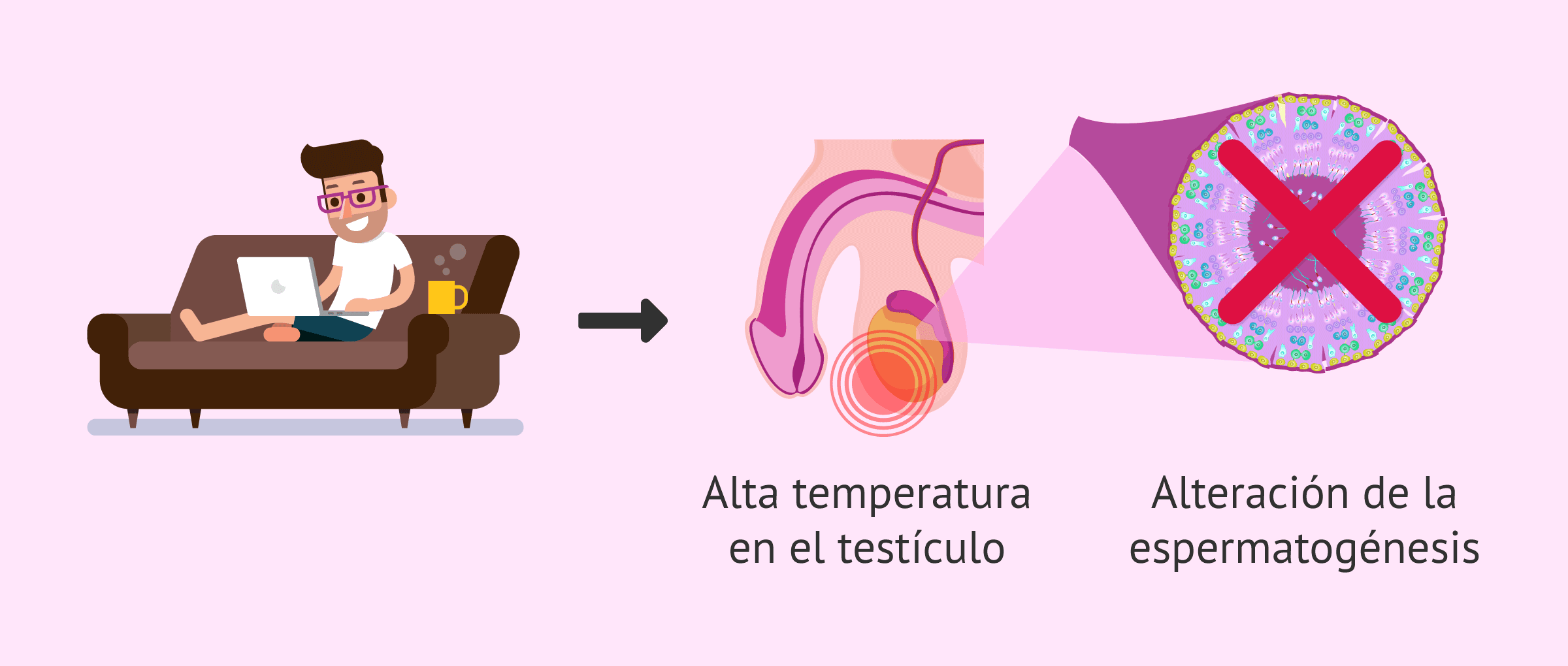 Imagen: Alta temperatura escrotal y producción espermática