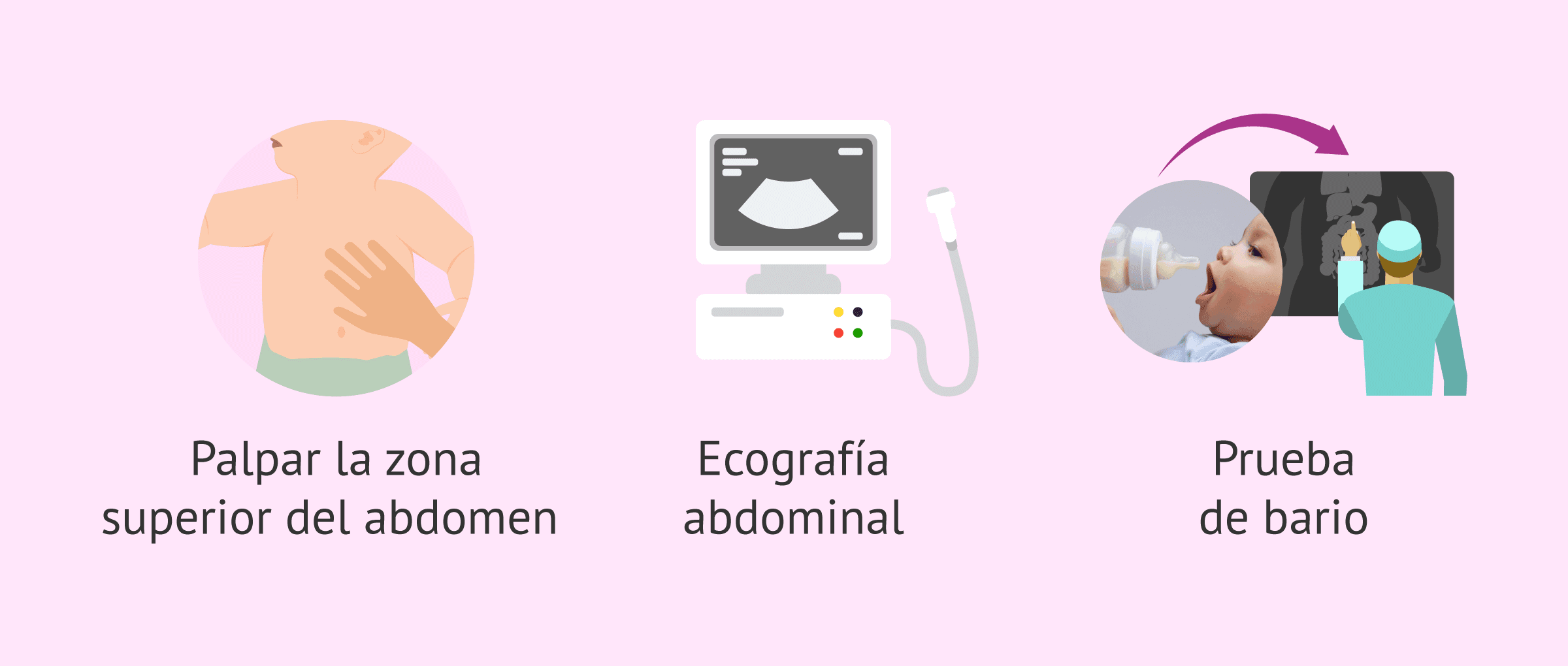 Imagen: Diagnóstico de la estenosis pilórica