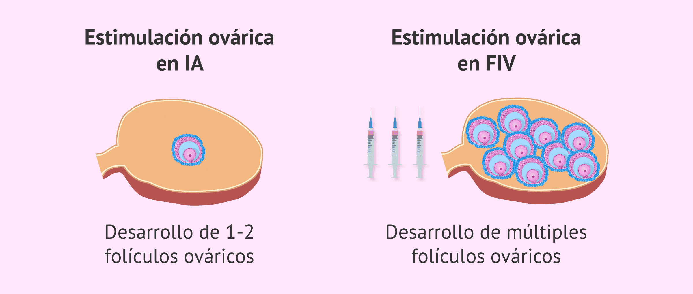 Imagen: Desarrollo folicular en la estimulación ovárica para IA y FIV
