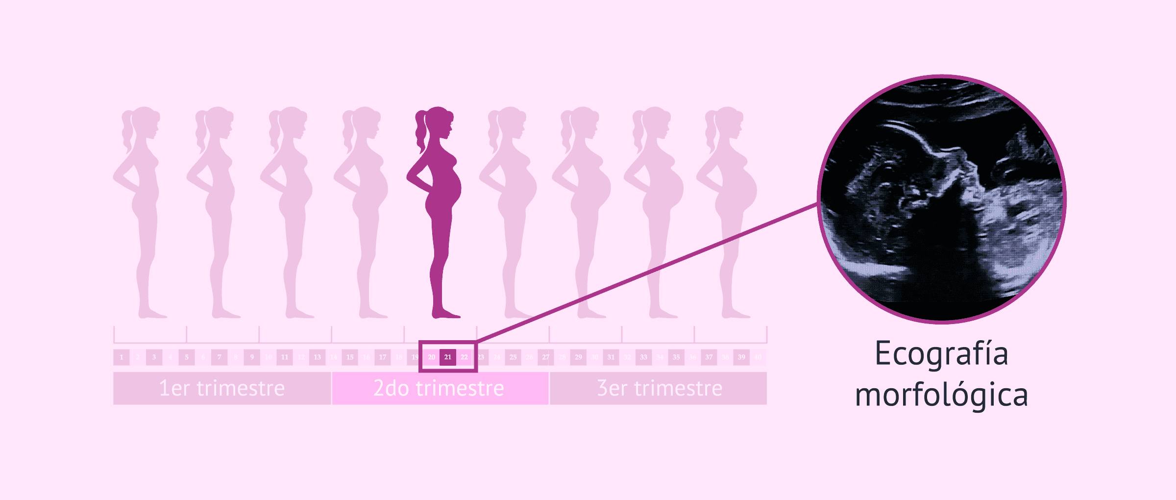 Imagen: Estudio precoz anatomia fetal