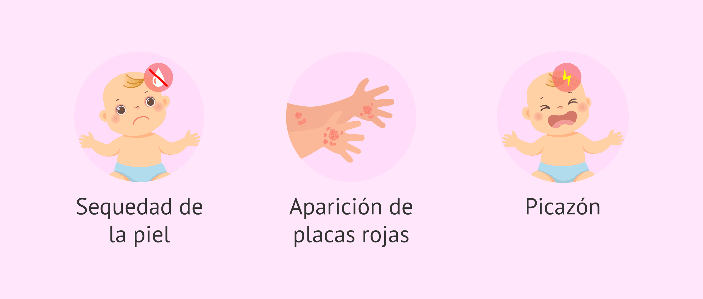 Imagen: Síntomas de la piel atópica en los bebés