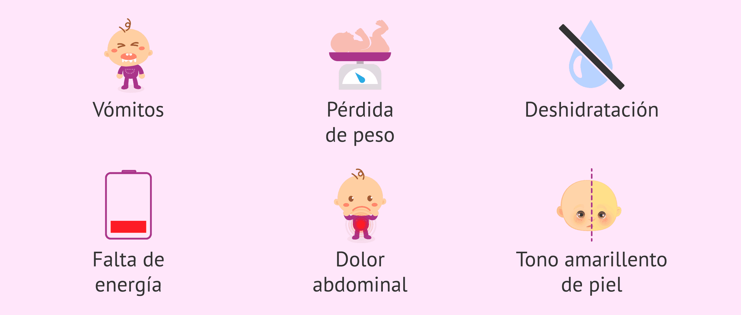 Imagen: Manifestaciones clínicas de la estenosis pilórica