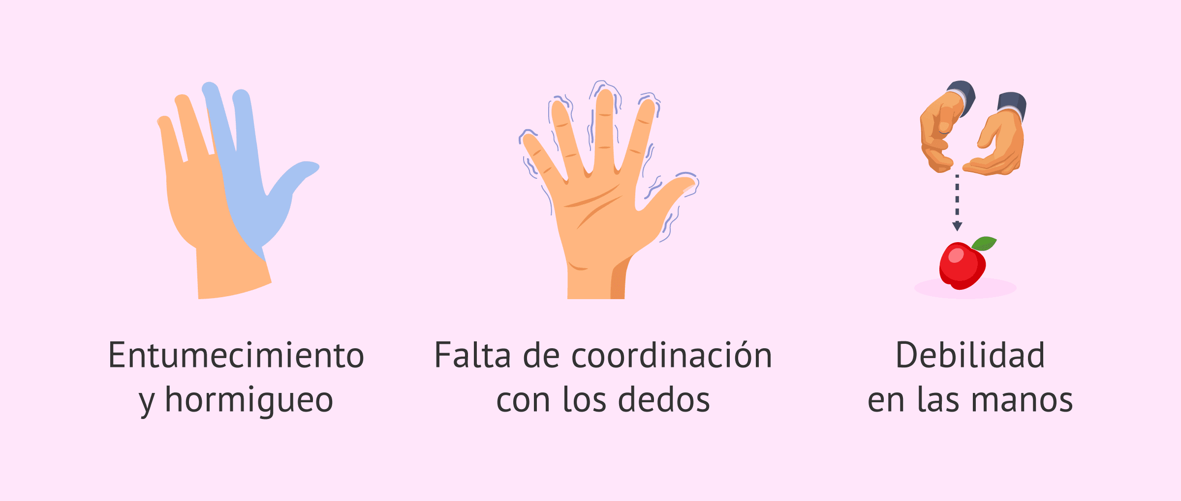 Imagen: Manifestaciones clínicas del síndrome del túnel carpiano