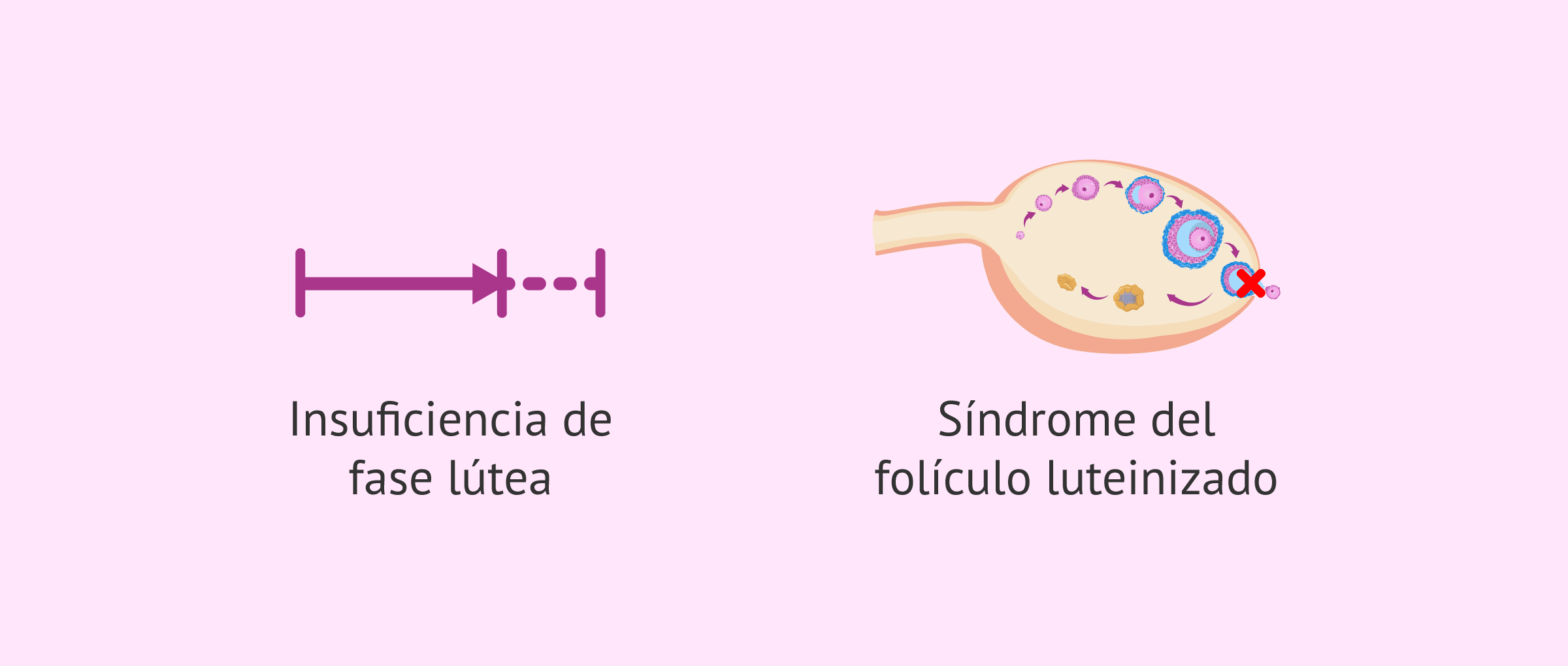 Imagen: Alteraciones relacionadas con la fase lútea