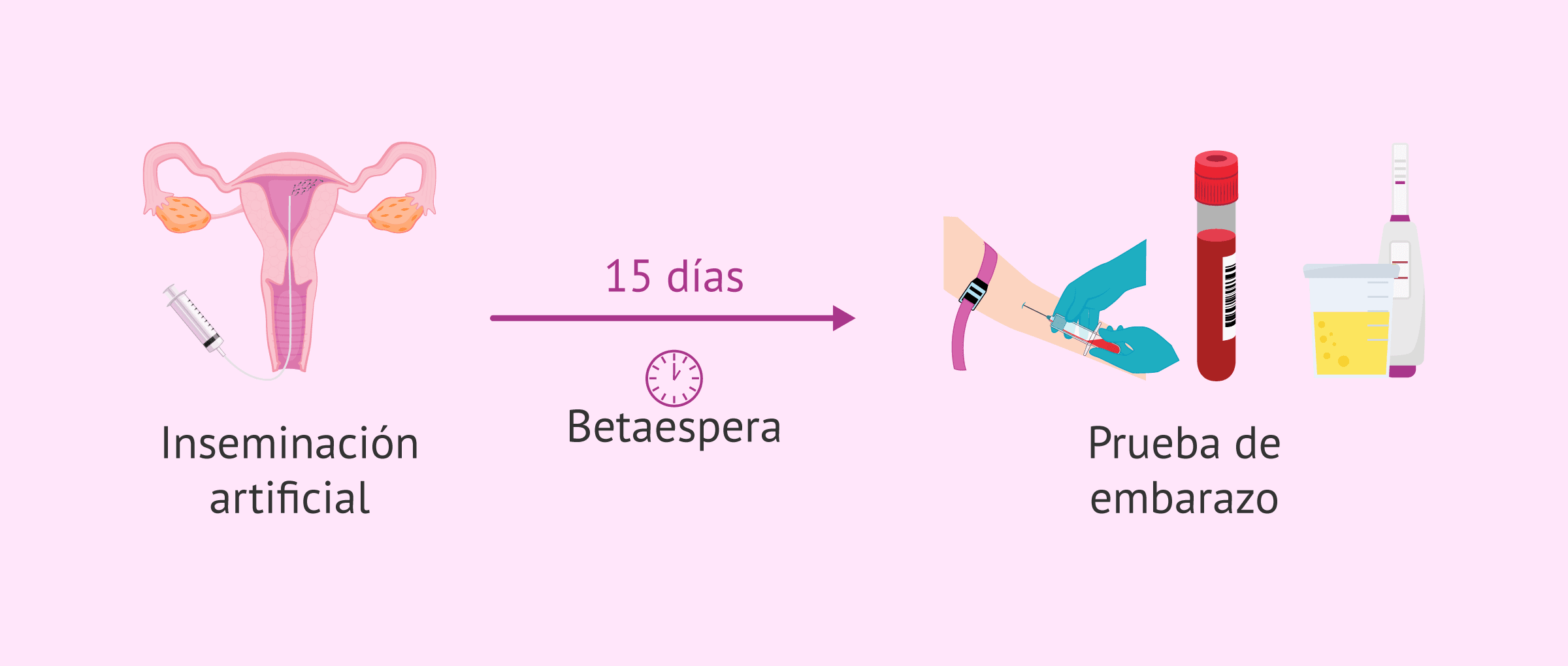 Imagen: Betaespera tras inseminación artificial (IA)