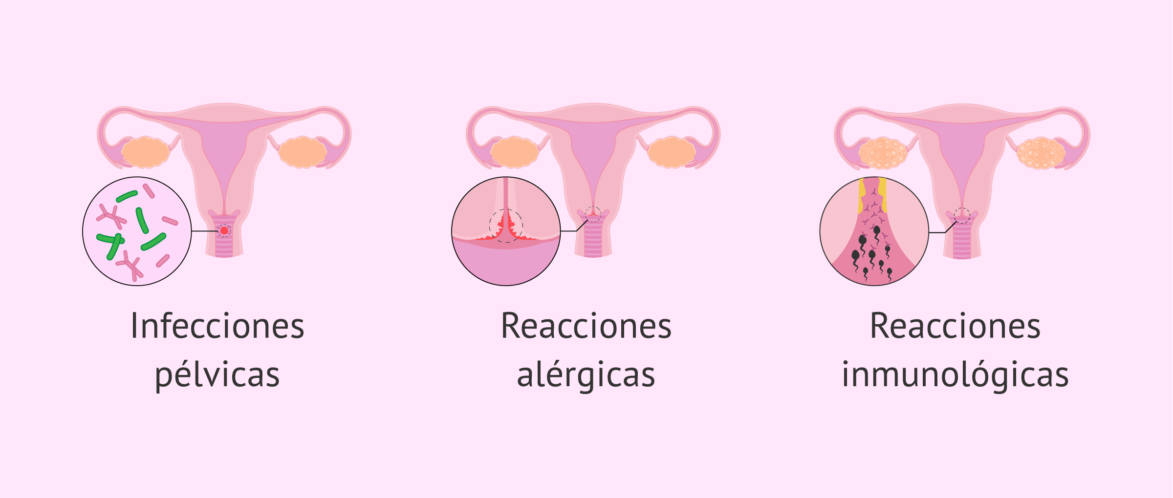 Imagen: ¿Qué problemas pueden surgir durante la inseminación?