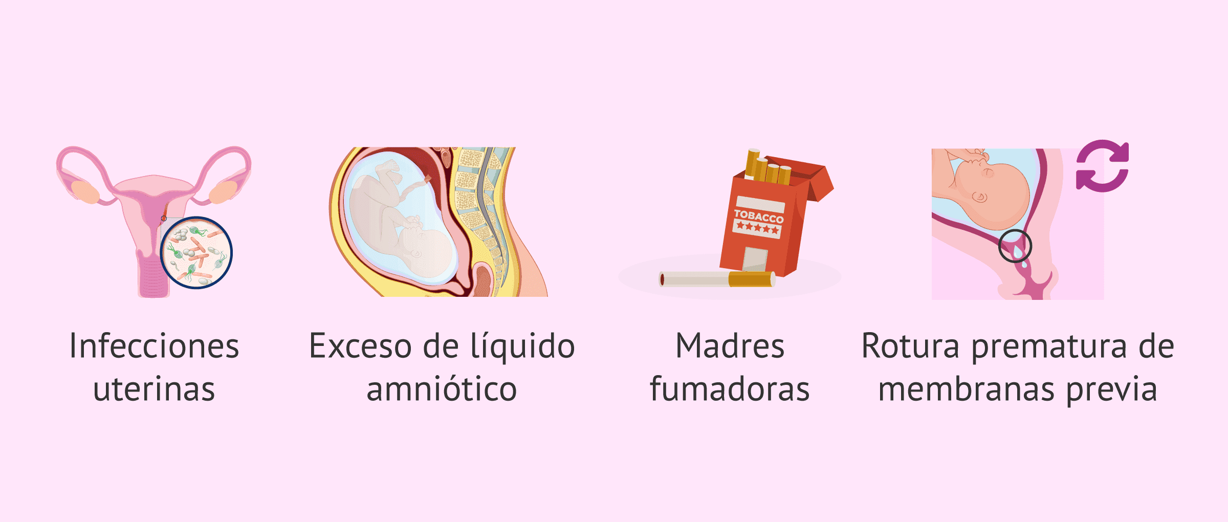 Imagen: Provocar el parto