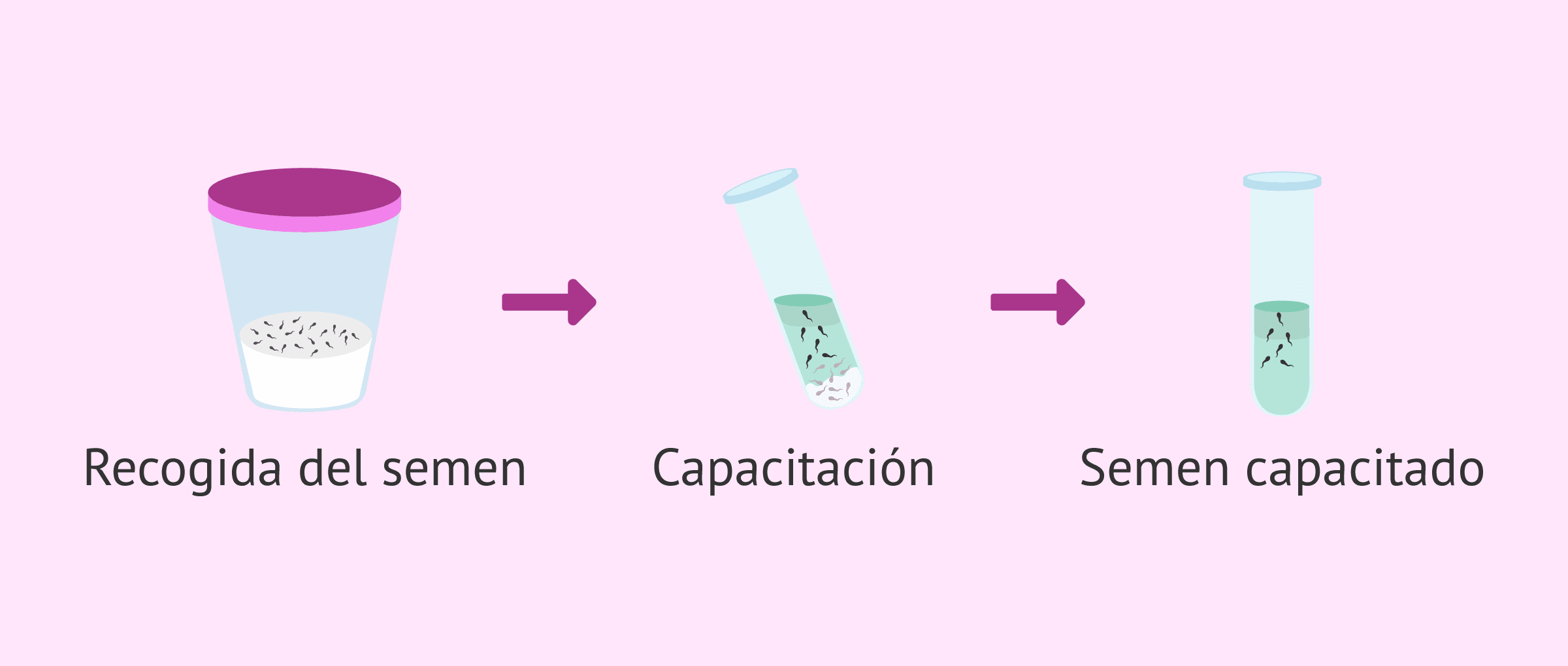 Imagen: Procesamiento de la muestra seminal