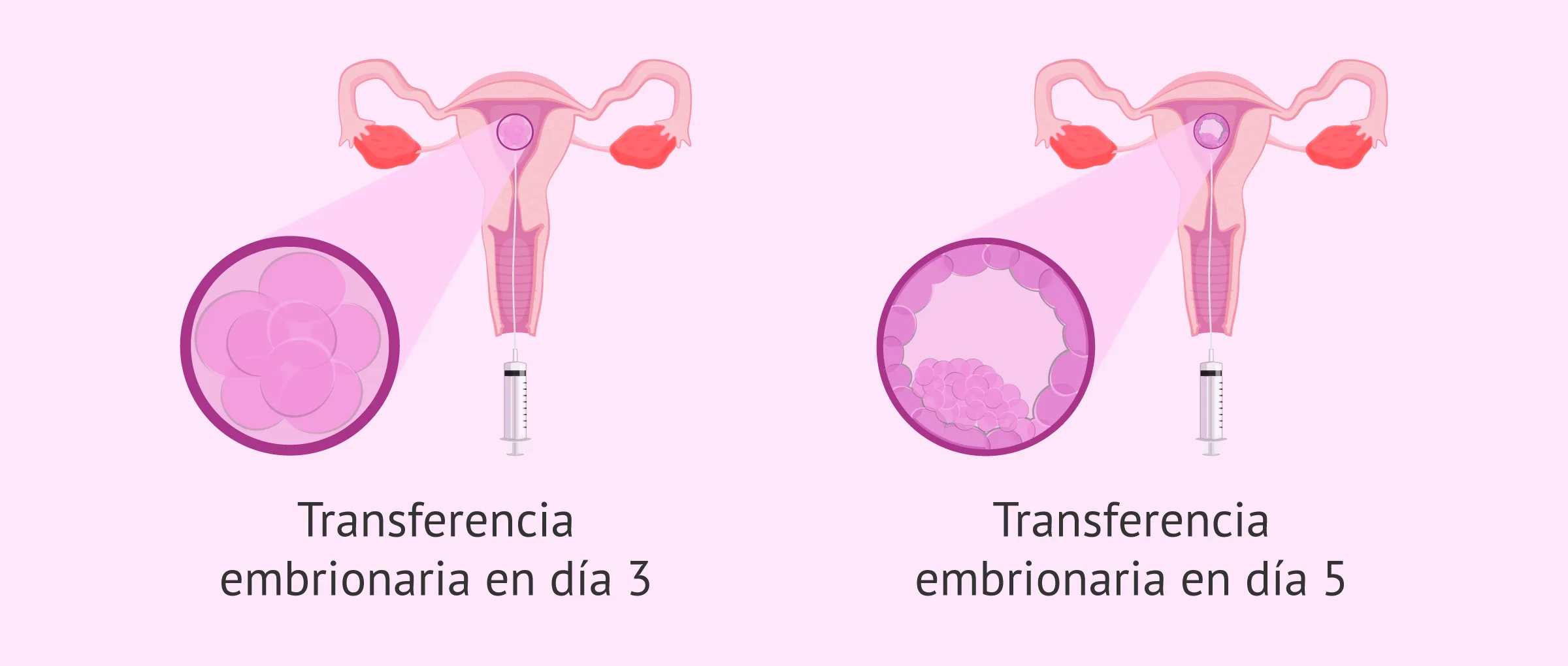 Imagen: ¿Qué día se realiza la transferencia embrionaria?
