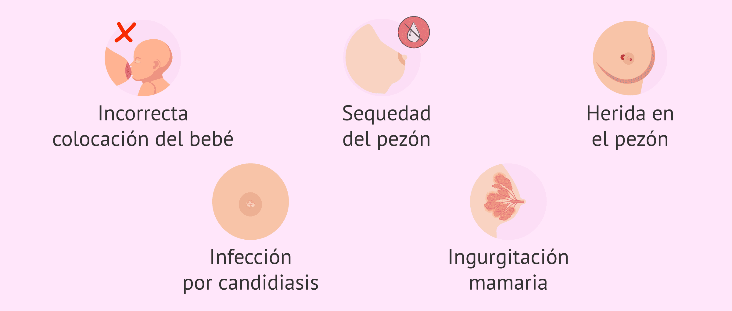 ¿Es normal el dolor en los senos durante la lactancia materna?