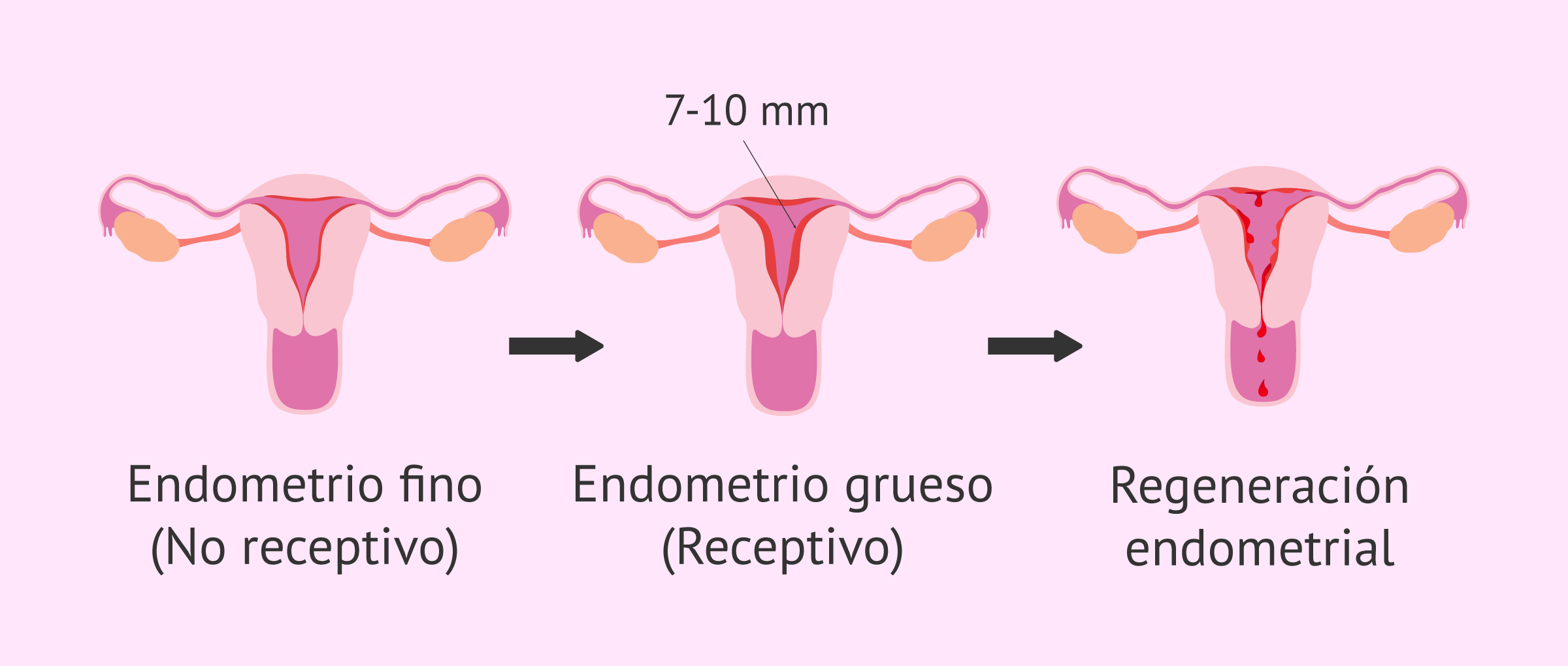 La receptividad uterina