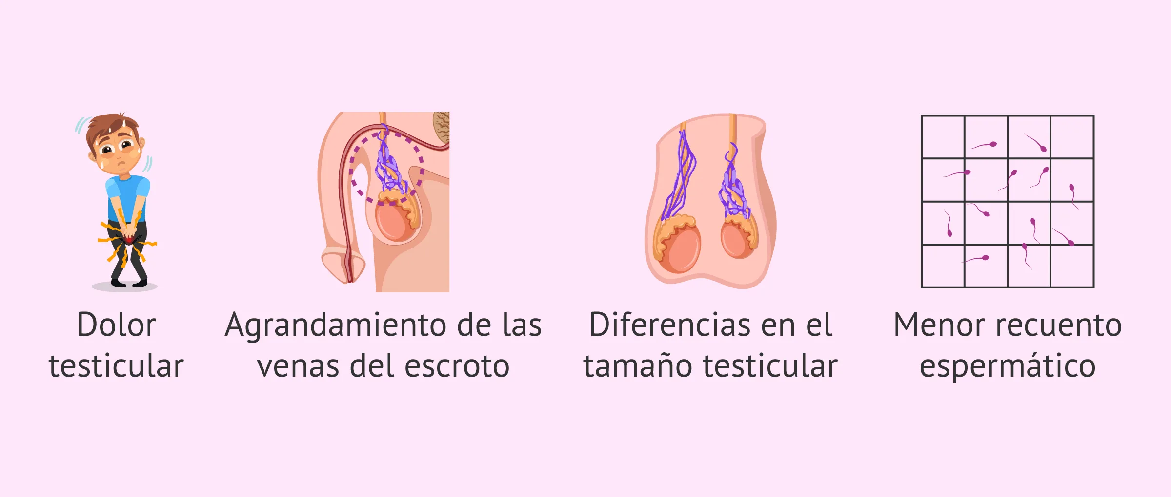 Signos y síntomas del varicocele