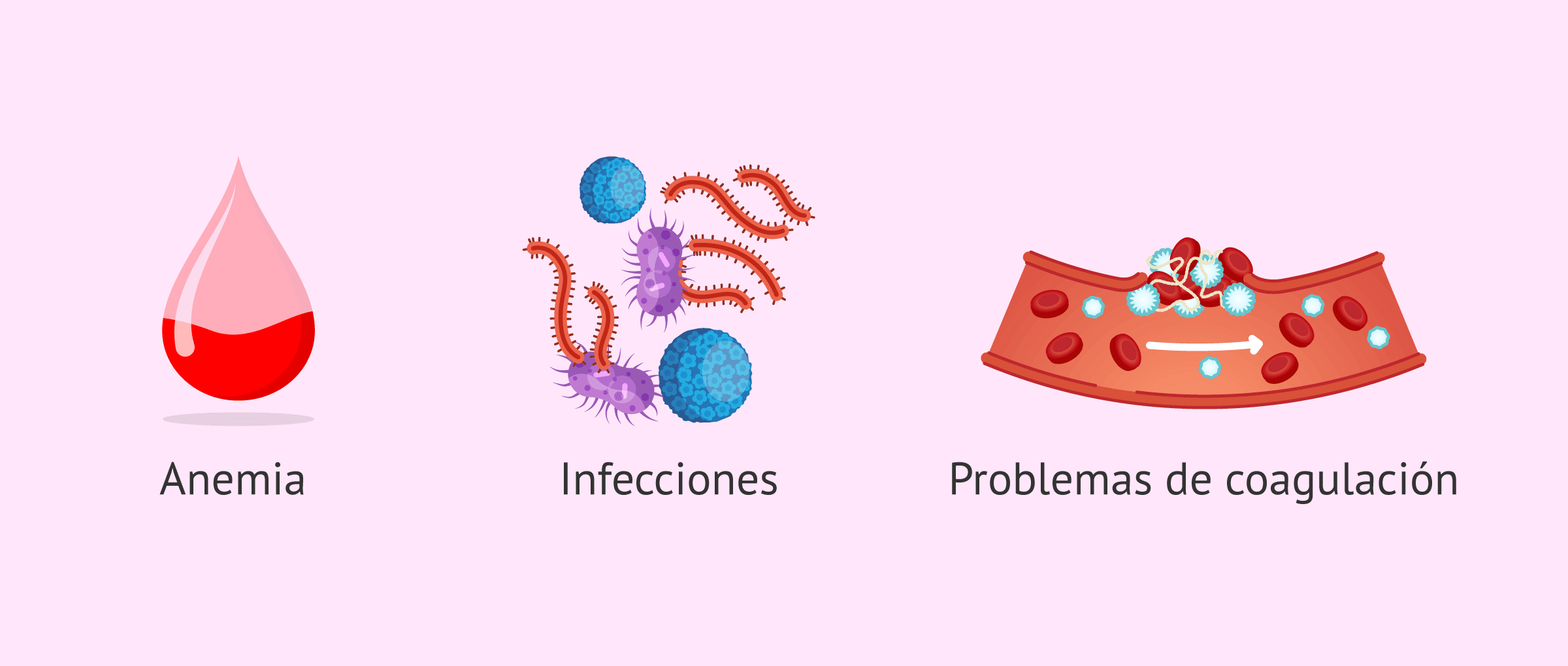 Imagen: Complicaciones de la anemia de Fanconi