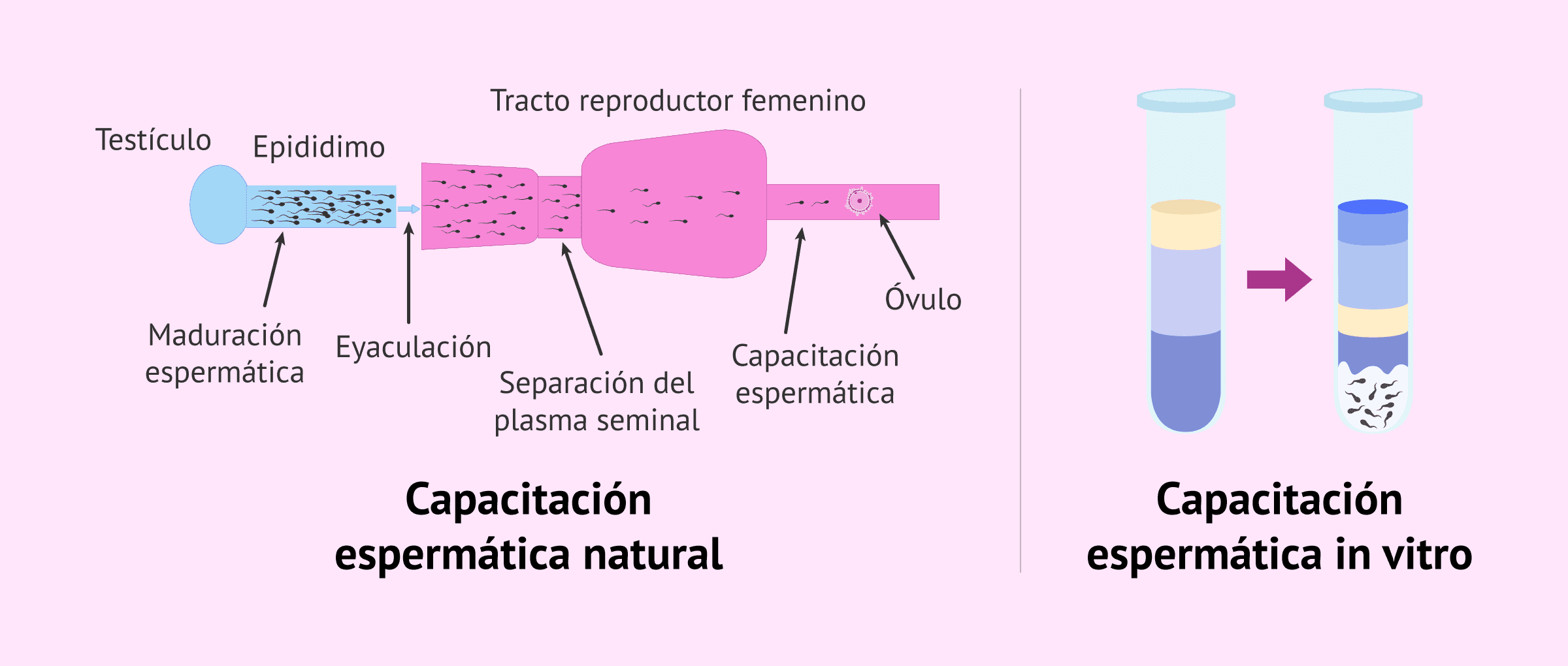 Imagen: Forma del espermatozoide