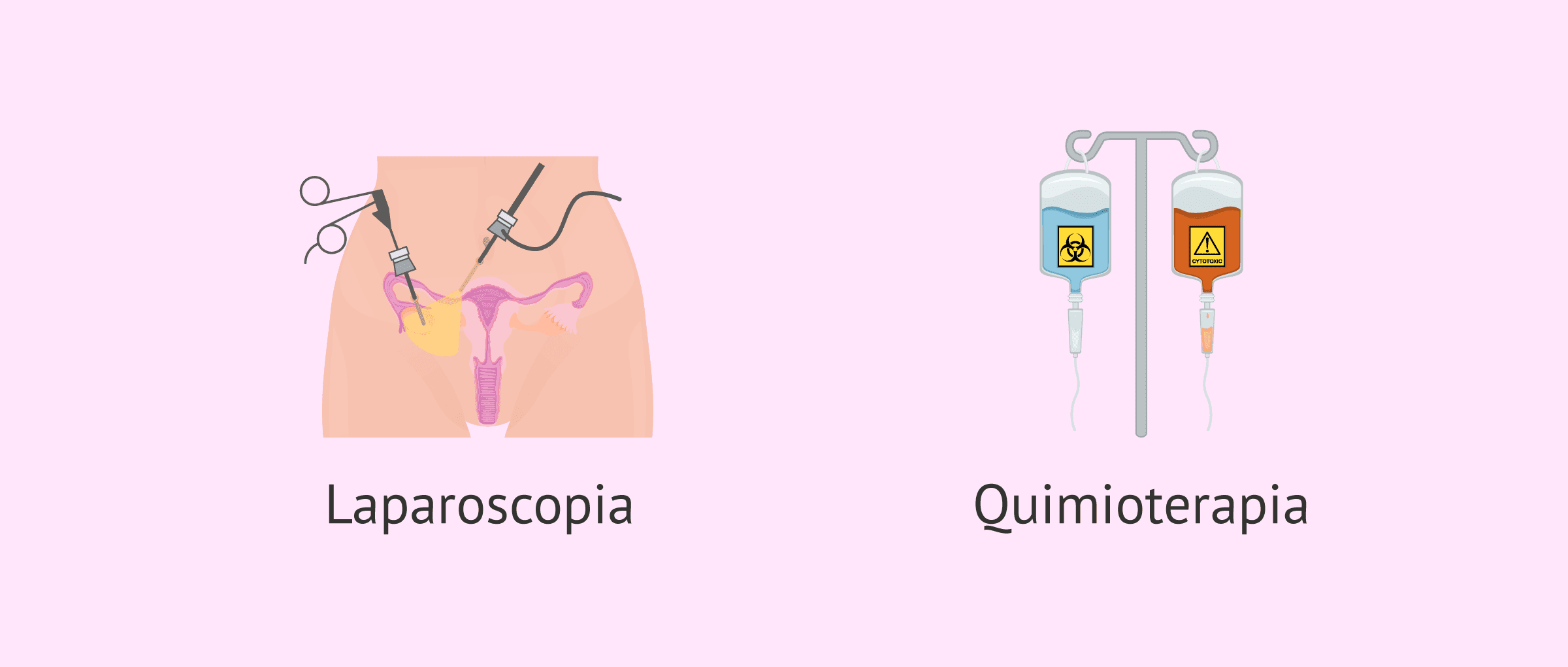 Imagen: tratamiento quirúrgico