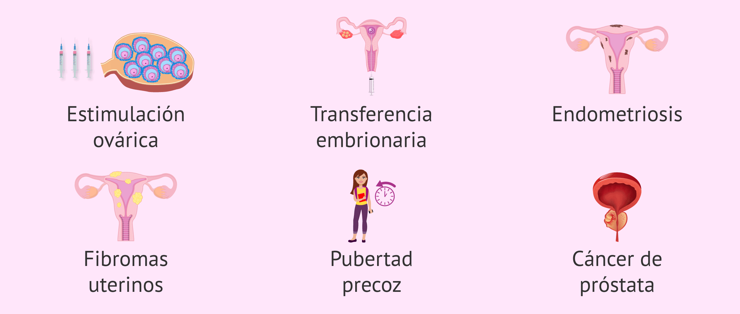 Imagen: ¿Cuándo está indicado el uso de decapeptyl?