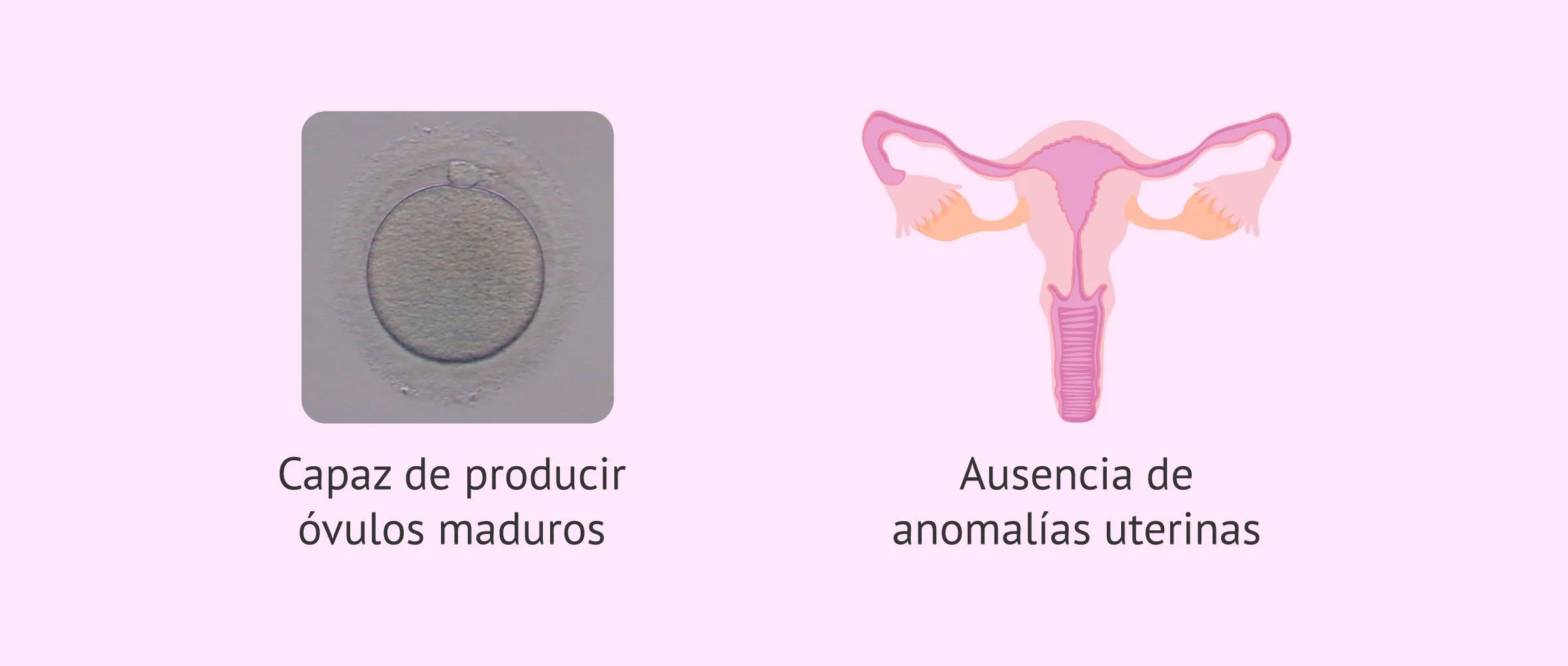 Imagen: Requisitos en las mujeres para un embarazo por FIV