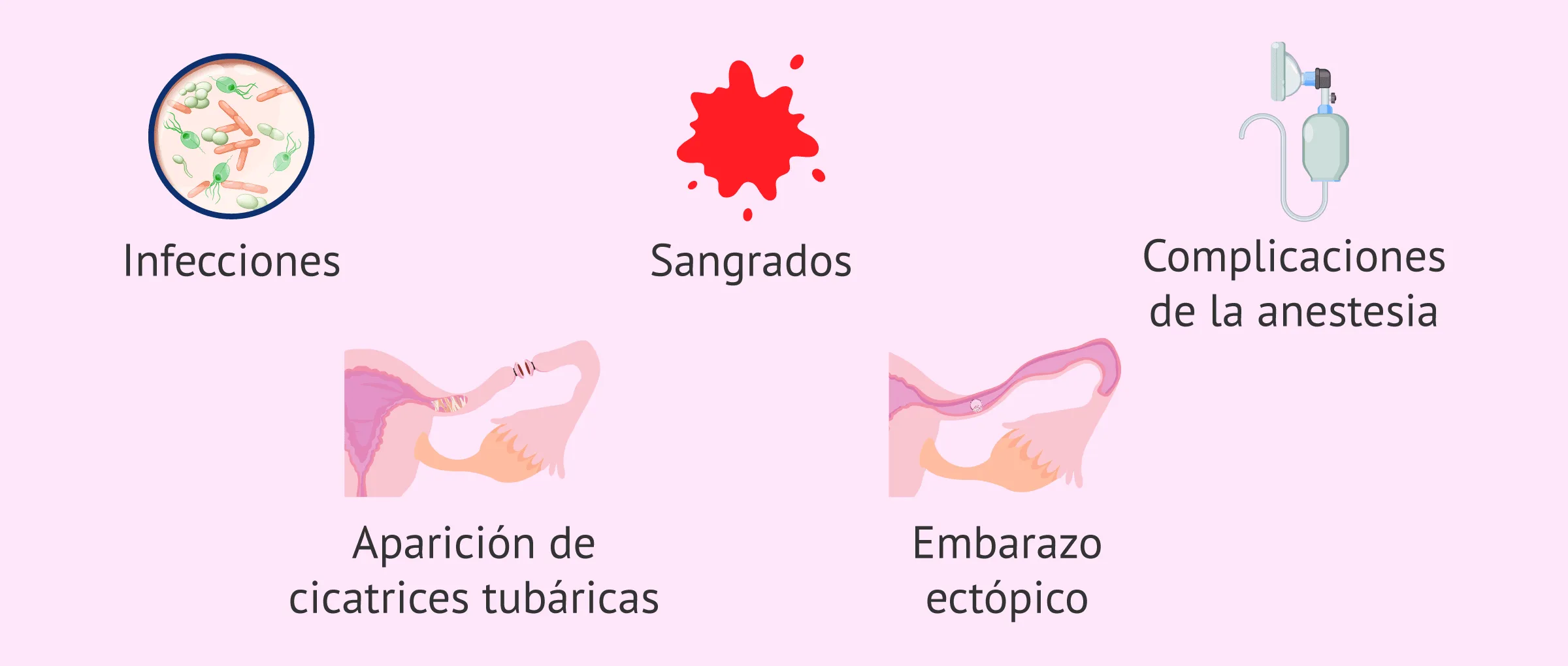 Riesgos de la recanalización tubárica