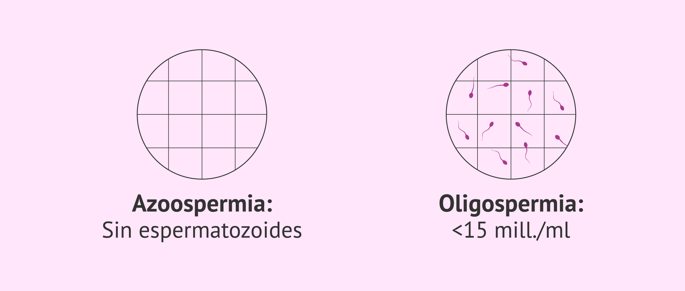 Imagen: ¿Oligospermia progresa a azoospermia?