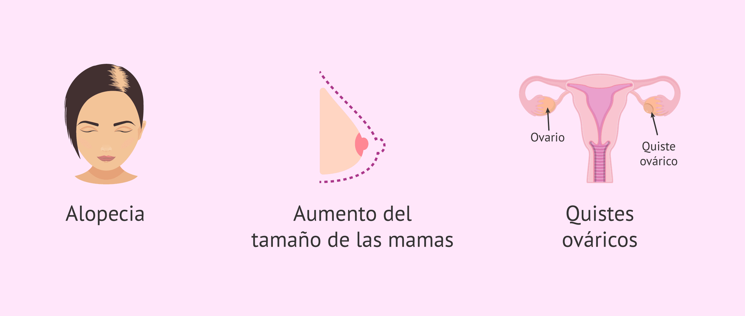 Imagen: Efectos secundarios poco frecuentes del Synarel