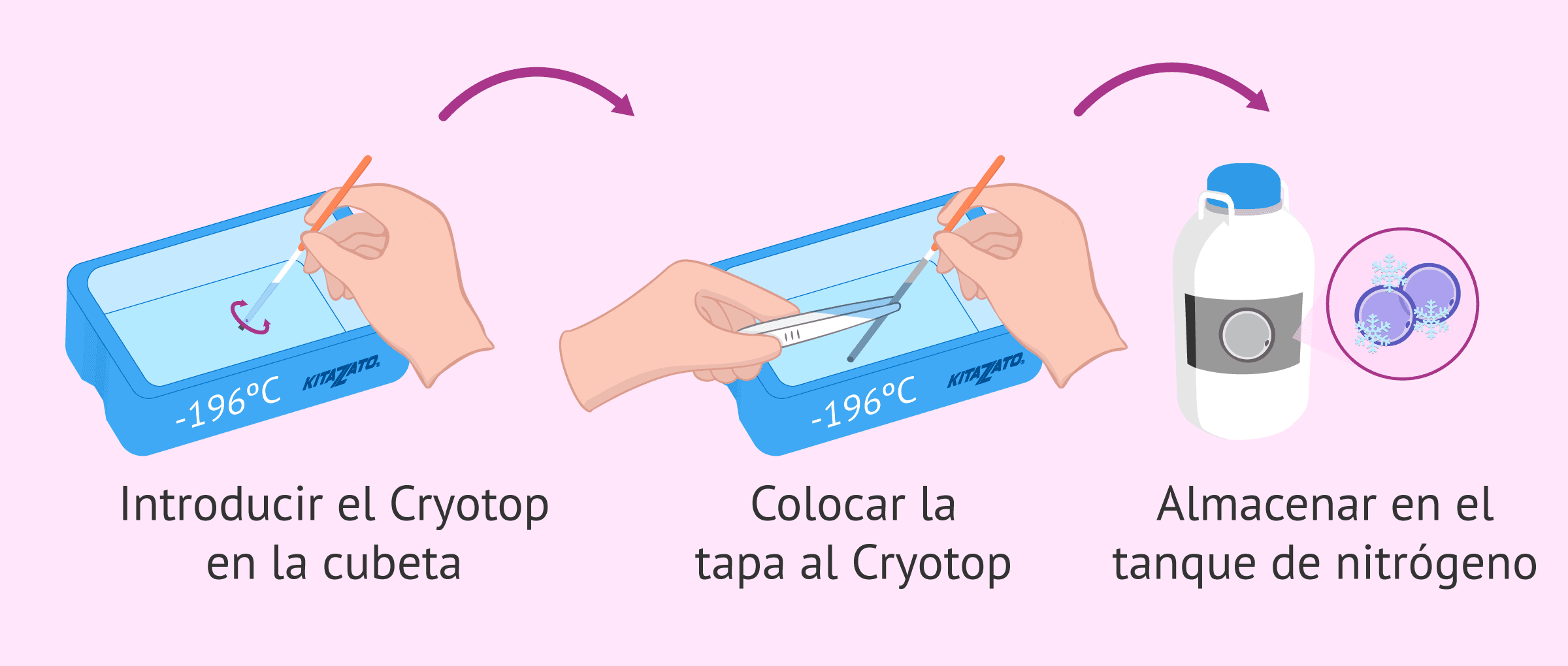 Imagen: Introducción del Cryotop en nitrógeno líquido