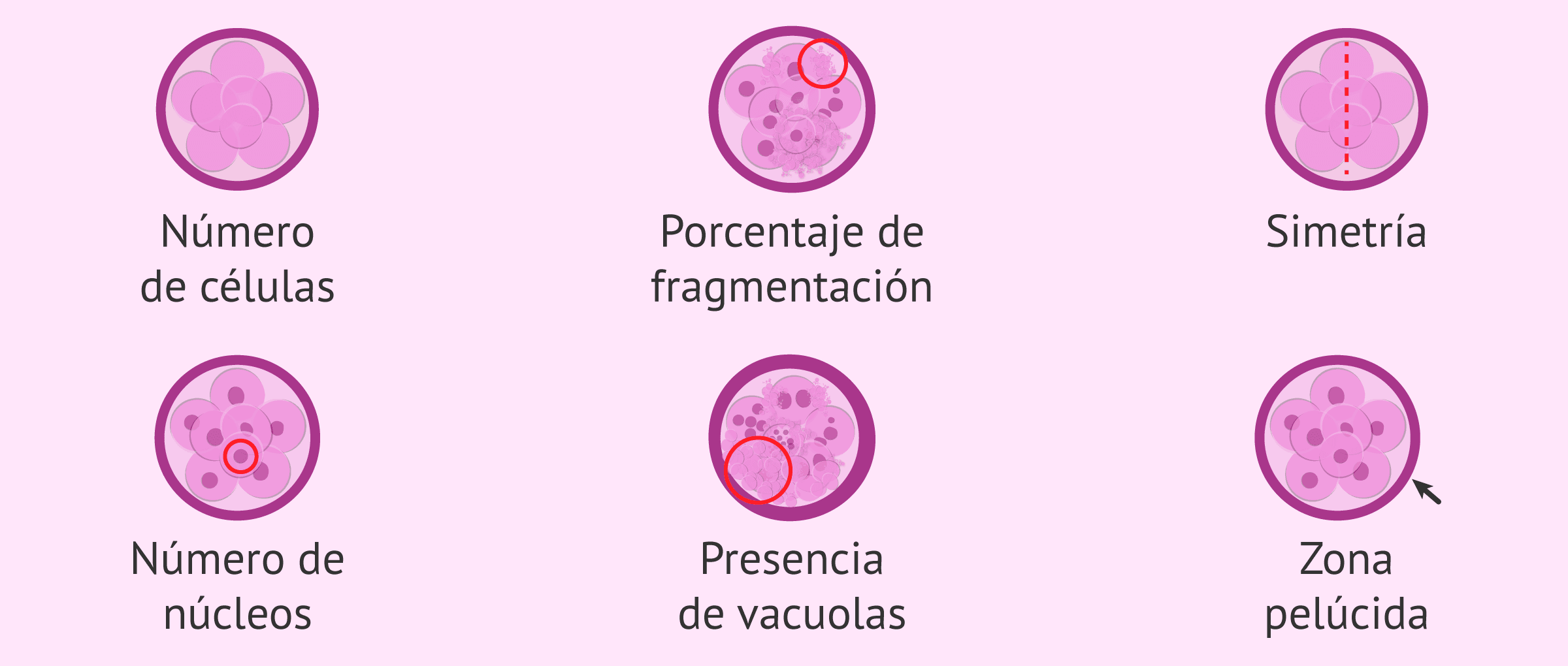 Imagen: Parámetros para evaluar la calidad embrionaria