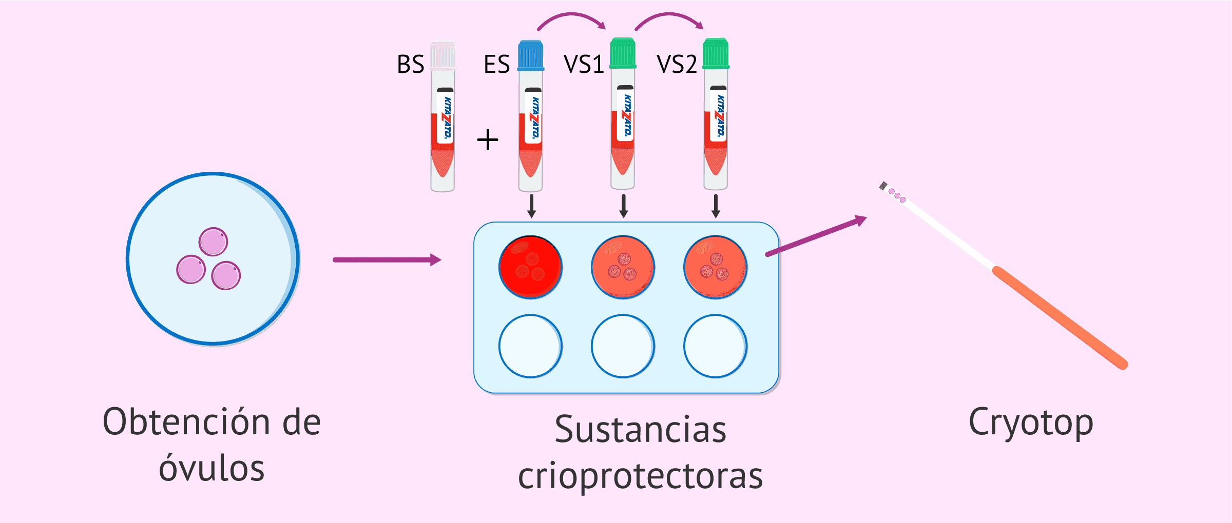 ¿Qué es la vitrificación de óvulos y cuáles son sus ventajas?