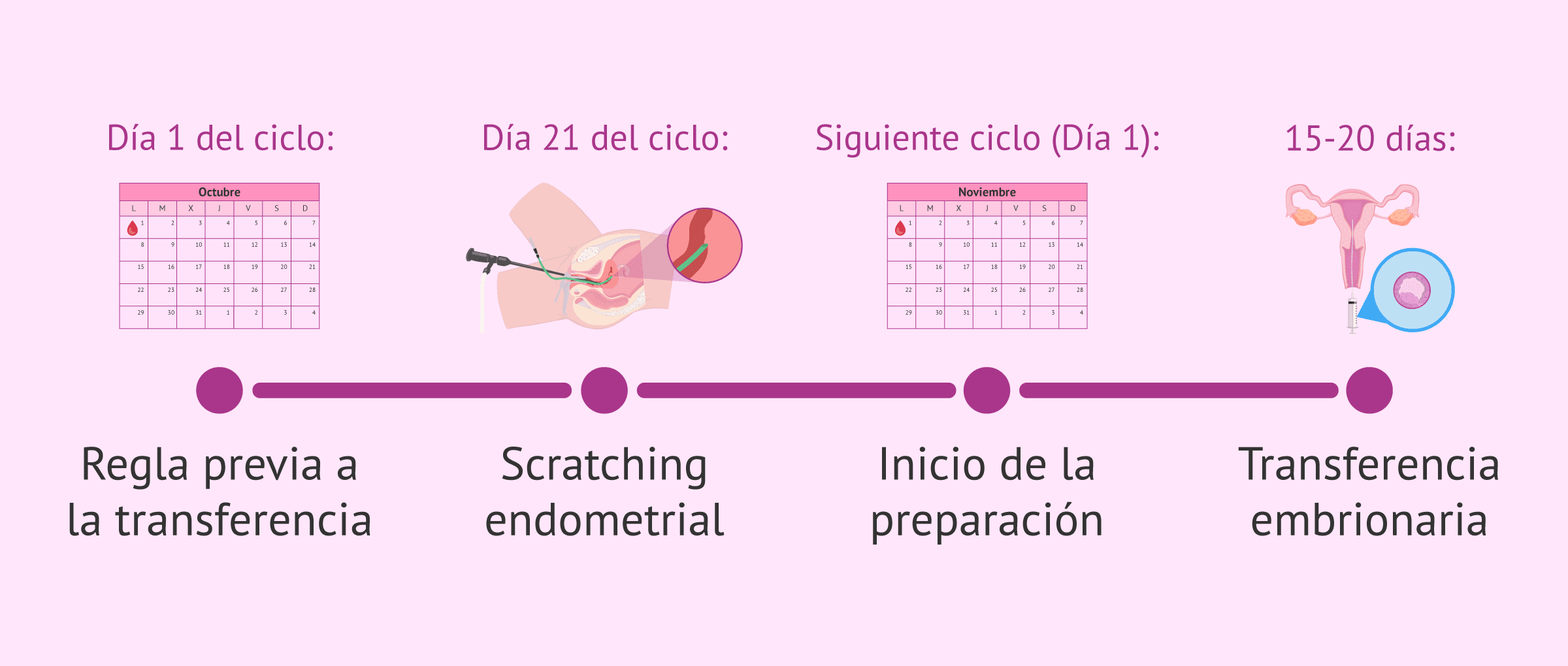 Imagen: Momento para hacer el raspado endometrial