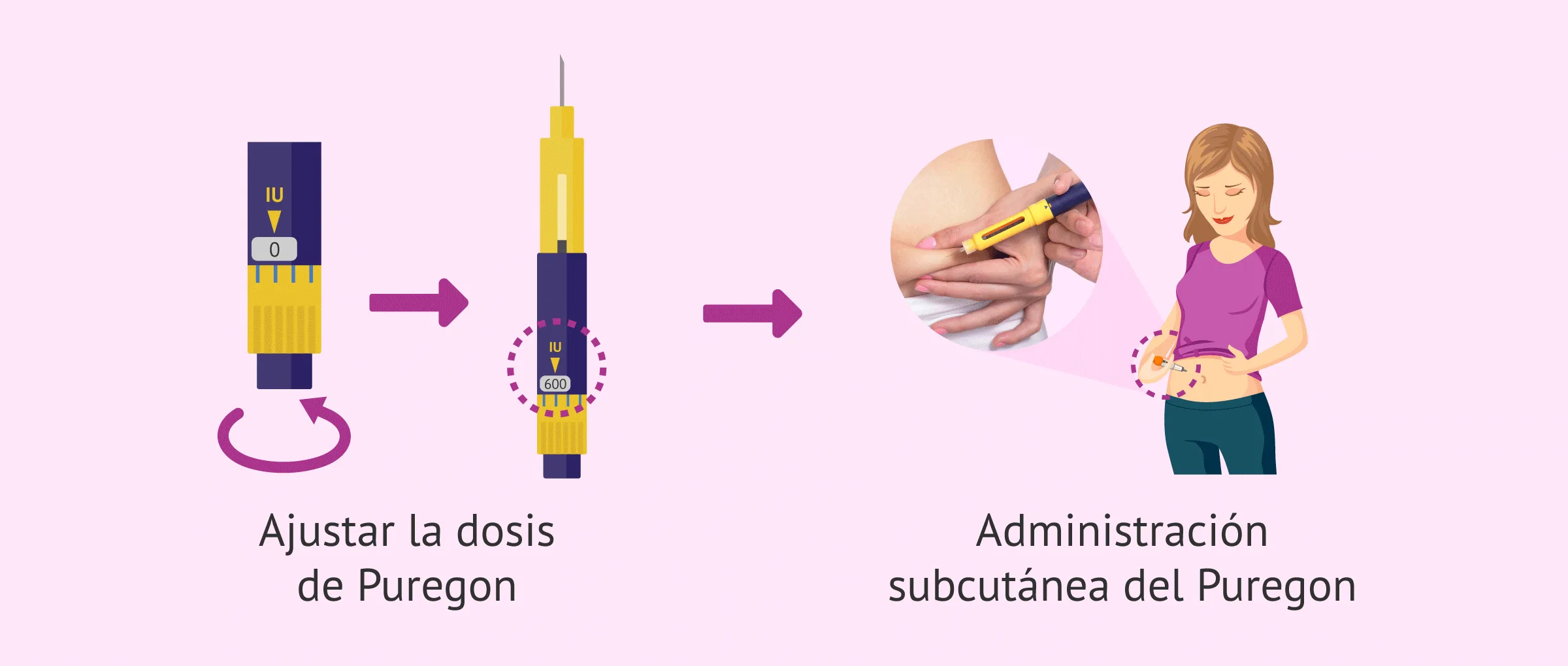 Imagen: ¿Cómo se administra el Puregon 600?