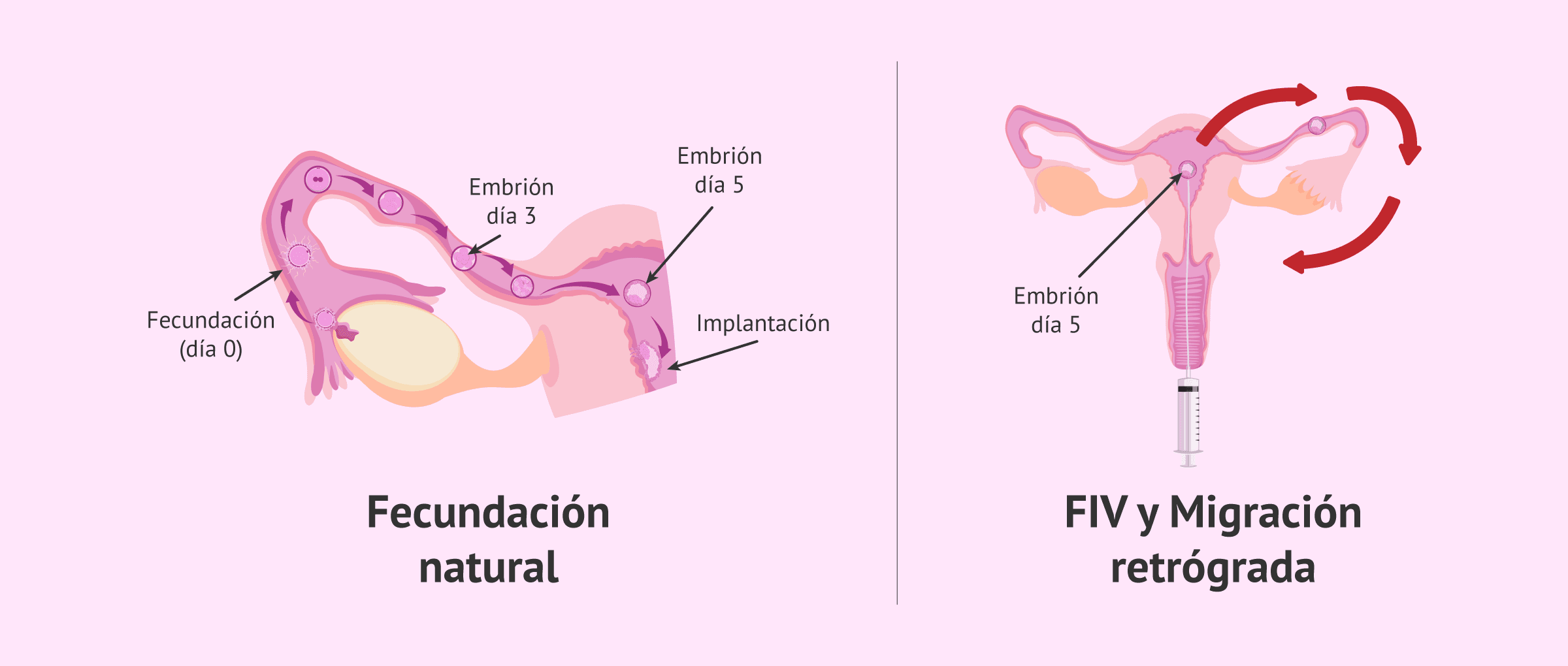 Imagen: Fecundación natural, FIV y migración retrógrada