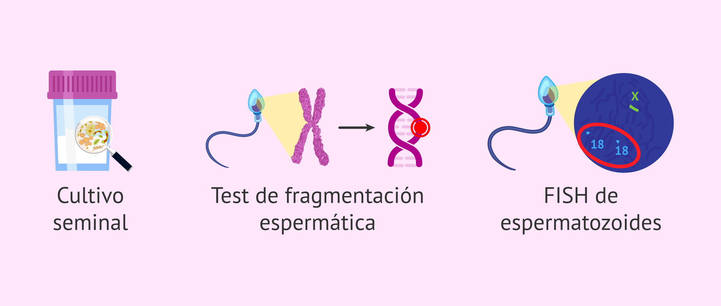 Imagen: Pruebas complementarias a un seminograma